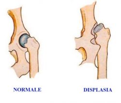 immagine-displasia-d8ffaa2e
